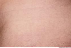 Photo Textures of Human Skin